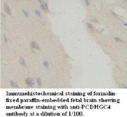 Anti-PCDHGC4 Antibody