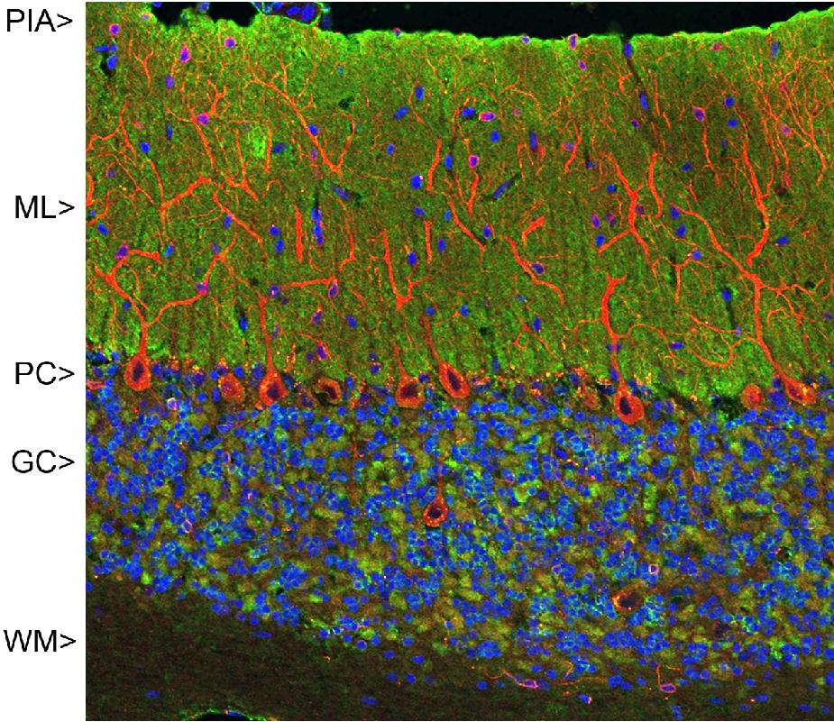 Anti-HSD17B11 Antibody