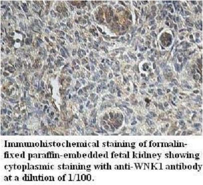Anti-WNK1 Antibody
