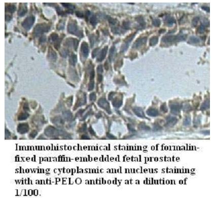 Anti-PELO Antibody