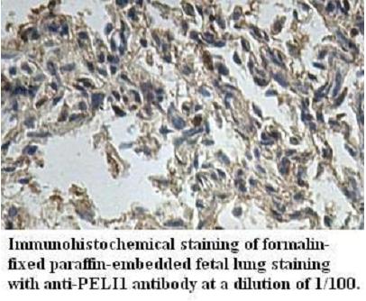 Anti-PELI1 Antibody