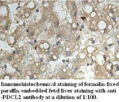 Anti-PDCL2 Antibody