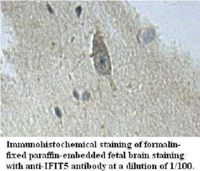 Anti-IFIT5 Antibody