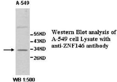 Anti-ZNF146 Antibody
