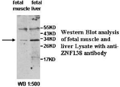 Anti-ZNF138 Antibody