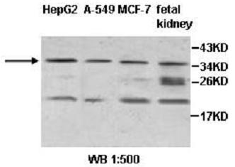 Anti-ZNF101 Antibody