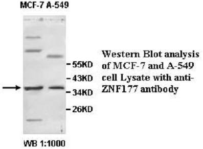 Anti-ZNF177 Antibody
