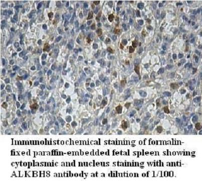 Anti-ALKBH8 Antibody
