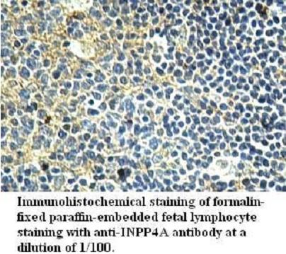 Anti-INPP4A Antibody