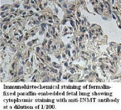 Anti-INMT Antibody