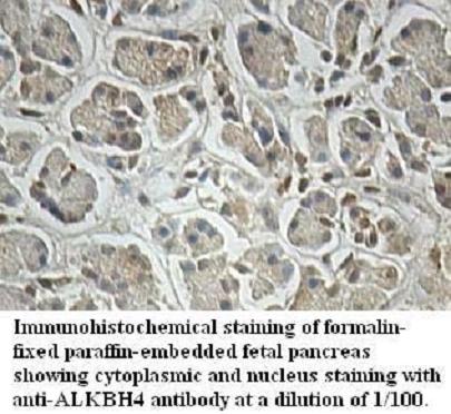Anti-ALKBH4 Antibody