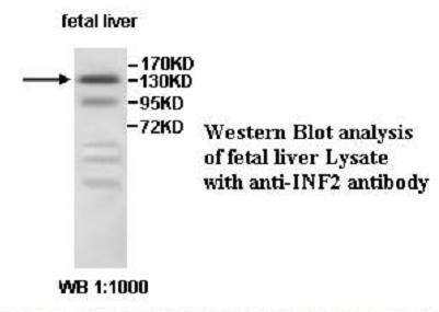 Anti-INF2 Antibody