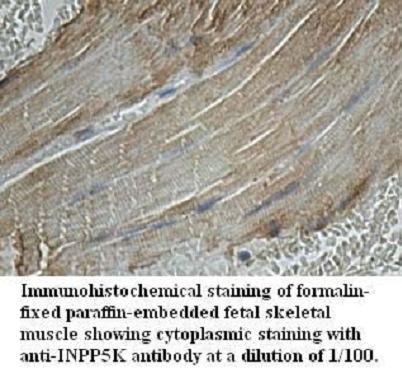 Anti-INPP5K Antibody