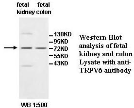 Anti-TRPV6 Antibody