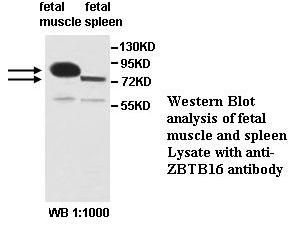 Anti-ZBTB16 Antibody