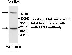 Anti-JAG1 Antibody