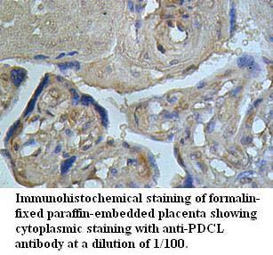 Anti-PDCL Antibody