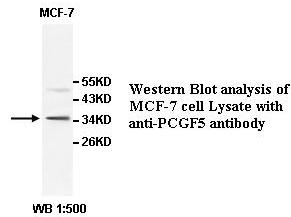 Anti-PCGF5 Antibody