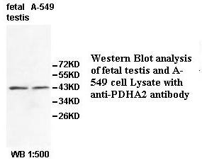 Anti-PDHA2 Antibody