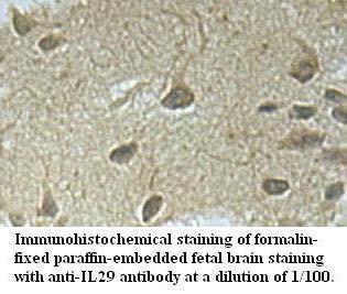 Anti-IL29 Antibody
