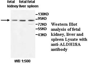 Anti-ALDH18A Antibody