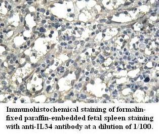 Anti-IL34 Antibody