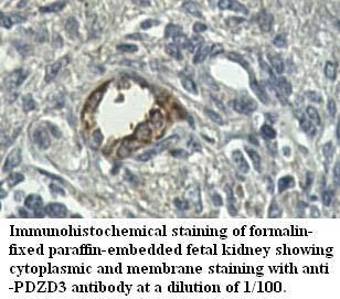 Anti-PDZD3 Antibody