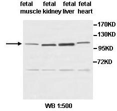 Anti-PDE3A Antibody
