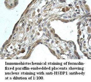 Anti-HSBP1 Antibody