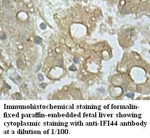 Anti-IFI44 Antibody