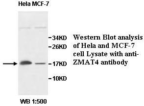 Anti-ZMAT4 Antibody