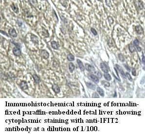 Anti-IFIT2 Antibody