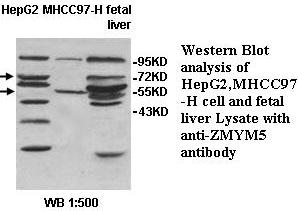 Anti-ZMYM5 Antibody