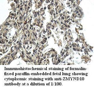 Anti-ZMYND10 Antibody