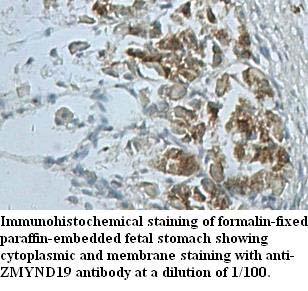 Anti-ZMYND19 Antibody