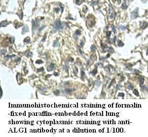 Anti-ALG1 Antibody