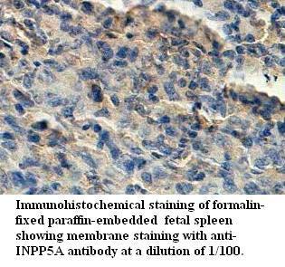 Anti-INPP5A Antibody
