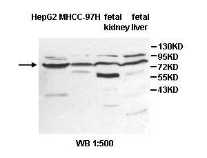 Anti-ZNF182 Antibody