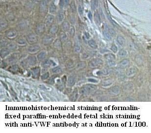 Anti-VWF Antibody