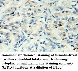 Anti-NEDD4 Antibody