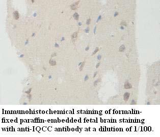 Anti-IQCC Antibody