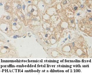 Anti-PHACTR4 Antibody
