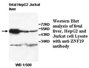 Anti-ZNF19 Antibody