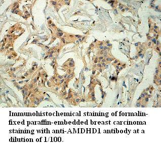 Anti-AMDHD1 Antibody