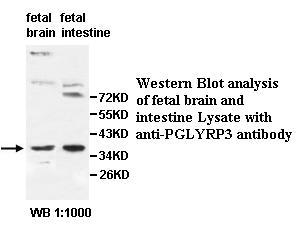 Anti-PGLYRP3 Antibody