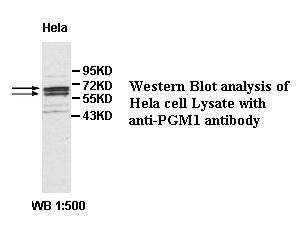 Anti-PGM1 Antibody