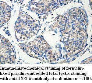 Anti-INSL6 Antibody