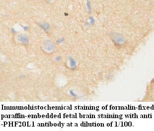 Anti-PHF20L1 Antibody