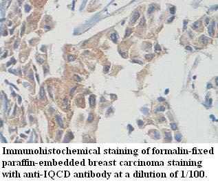 Anti-IQCD Antibody