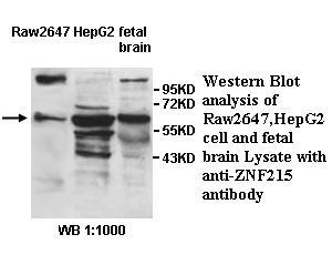 Anti-ZNF215 Antibody